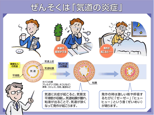 気管支炎咳嗽の治療法